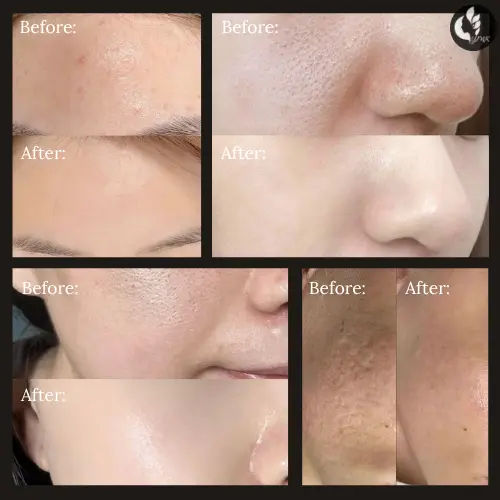 YMK All In One Lotion thumbnail 5